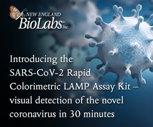 NEB-Introducing the SARS-COV-2 Rapid Colormetric LAMP Assay Kit-Find out More