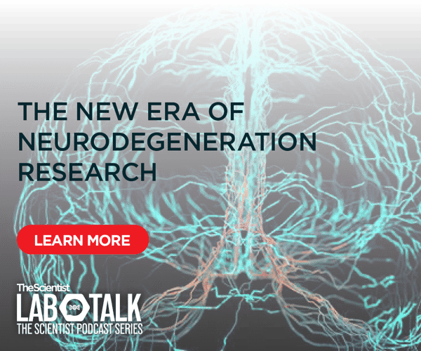 LabTalk - Neurodegeneration Research - Perkin (1)